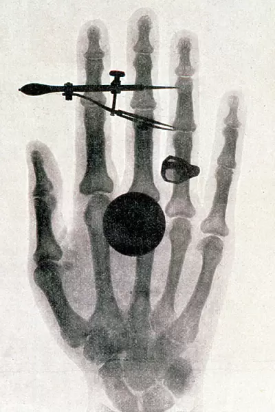 Wilhelm Roentgens X-ray photograph of his wifes hand, 1896. Artist: Wilhelm Conrad Rontgen