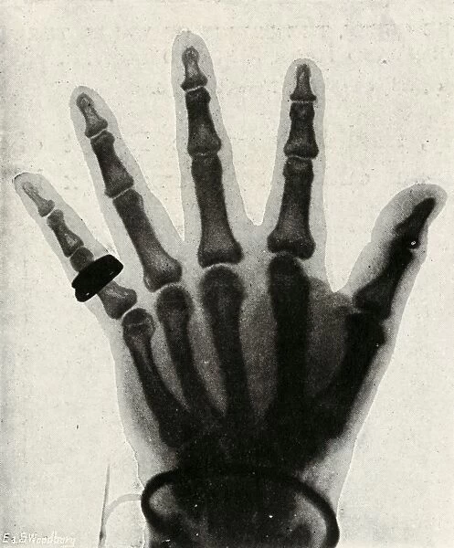 Radiograph of the Hand of H. R. H. The Prince of Wales, (c1897)