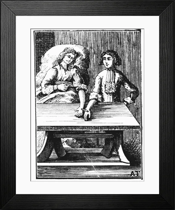 Framed Print : Direct person-to-person blood transfusion performed at the wrist, 1679 Framed Print : Direct person-to-person blood transfusion performed at the wrist, 1679