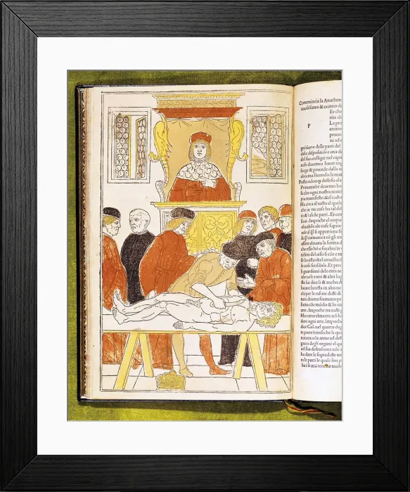 Framed Print : Anatomy lecture at Padua, Italy, 1483 Framed Print : Anatomy lecture at Padua, Italy, 1483