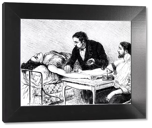Dr Roussell of Geneva giving a woman a direct blood transfusion from a volunteer, 1882