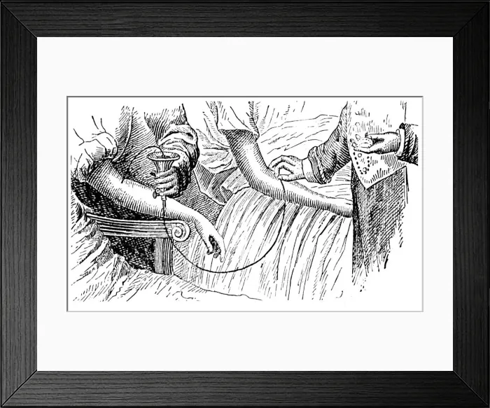 Framed Print : Blood transfusion, c1880 Framed Print : Blood transfusion, c1880