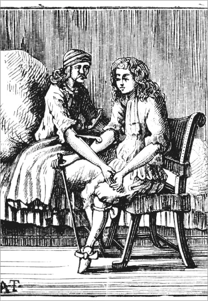 Direct person-to-person blood transfusion, 1679