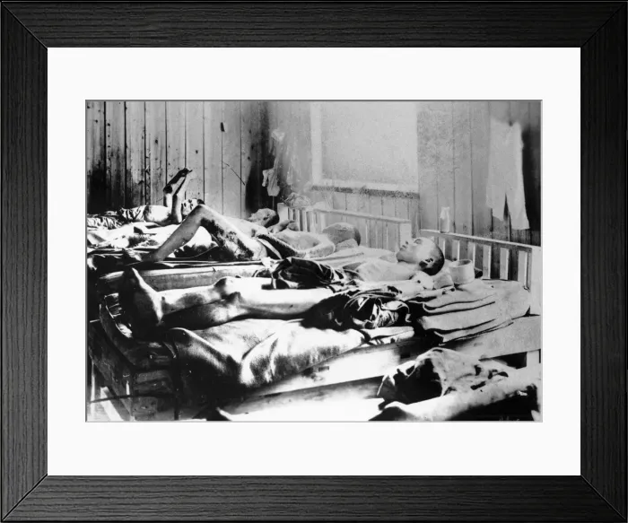 Framed Print : Survivors of the explosion of the Atom bomb at Hiroshima, Japan, 1945 Framed Print : Survivors of the explosion of the Atom bomb at Hiroshima, Japan, 1945