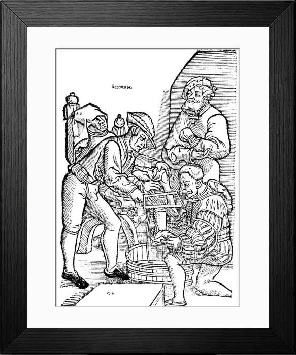 Framed Print : Amputation of a leg without anaesthetic, 1593 Framed Print : Amputation of a leg without anaesthetic, 1593