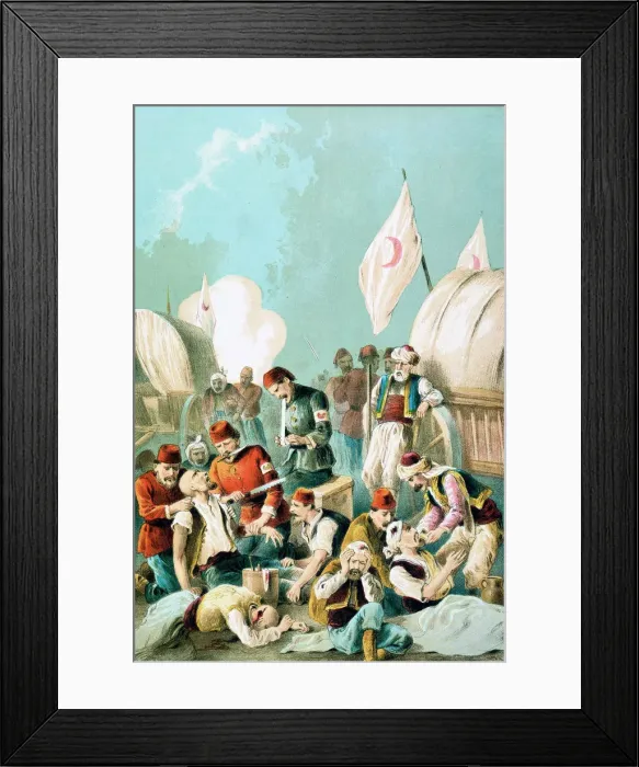 Framed Print : Arm being amputated without anaesthetic, Russo-Turkish War, 1877 Framed Print : Arm being amputated without anaesthetic, Russo-Turkish War, 1877