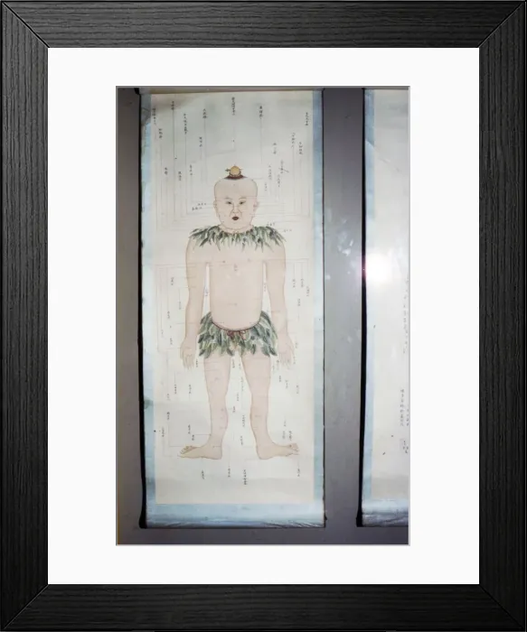 Framed Print : Chinese Acupuncture Chart, Front View Framed Print : Chinese Acupuncture Chart, Front View