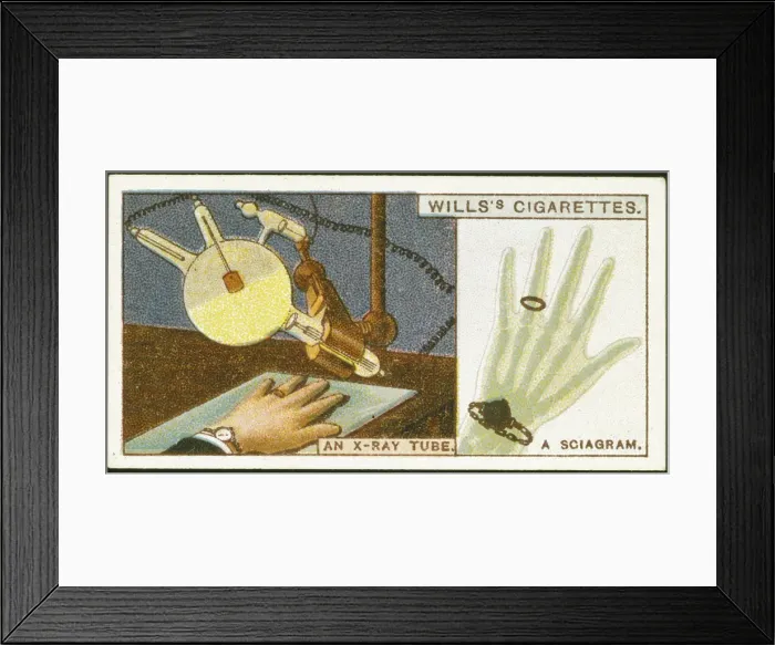 Framed Print : X-raying the hand, 1924 Framed Print : X-raying the hand, 1924