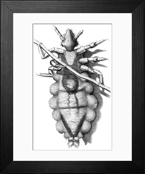 Framed Print : Louse clinging to a human hair, 1665 Framed Print : Louse clinging to a human hair, 1665