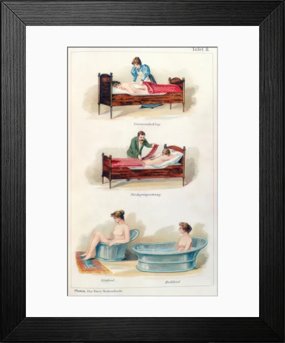 Framed Print : Hydrotherapy treatments, c1902 Framed Print : Hydrotherapy treatments, c1902