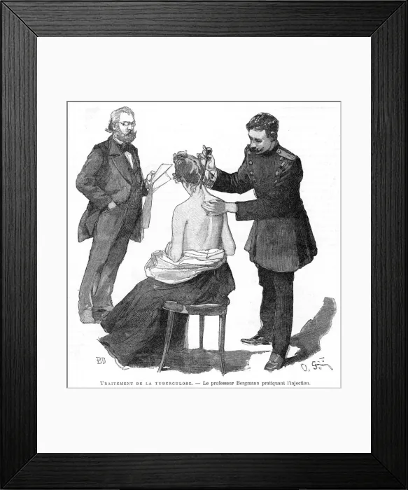 Framed Print : Professor Bergmann injecting a tuberculosis patient, 1891