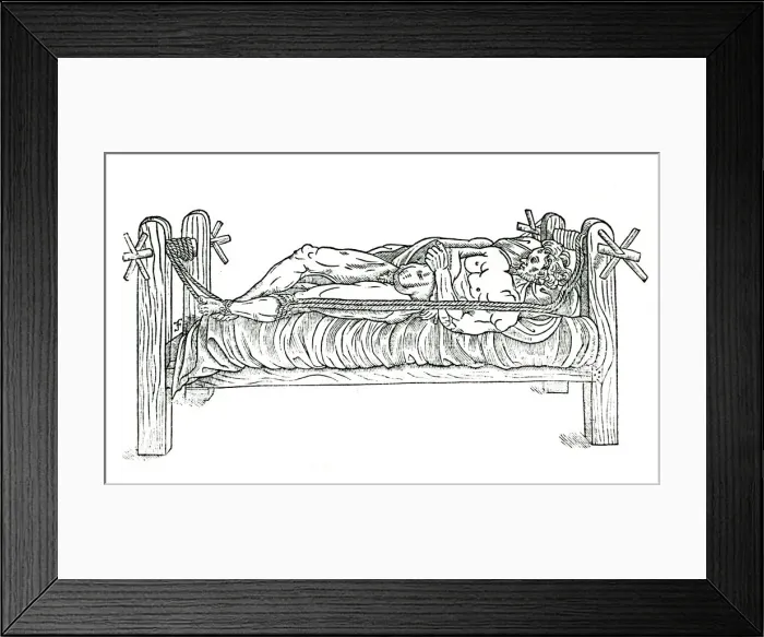 Framed Print : Apparatus for reducing dislocations, 1544 Framed Print : Apparatus for reducing dislocations, 1544