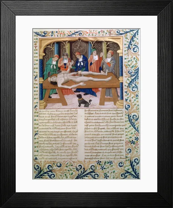 Framed Print : Dissection, late 15th century Framed Print : Dissection, late 15th century