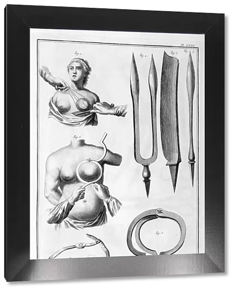 Breast surgery, 1751-1777