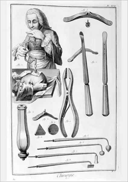Head surgery, 1751-1777