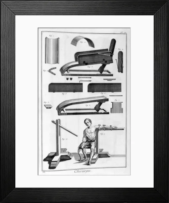 Framed Print : Surgery, 1751-1777 Framed Print : Surgery, 1751-1777