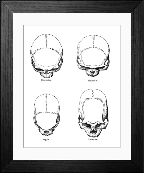 Framed Print : The vertical configuration of the skull, 1848 Framed Print : The vertical configuration of the skull, 1848