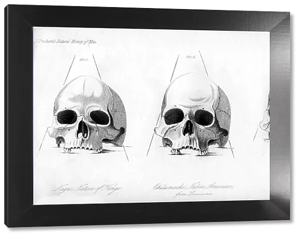 Three types of human skull, 1848