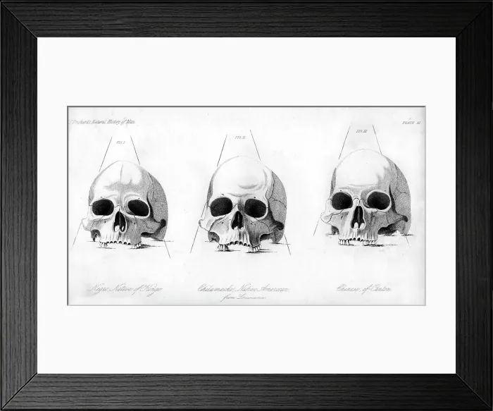 Framed Print : Three types of human skull, 1848 Framed Print : Three types of human skull, 1848