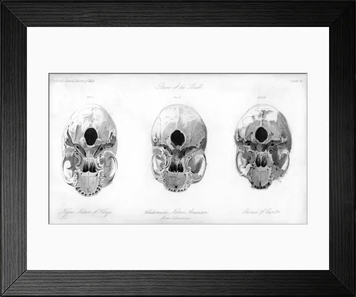 Framed Print : Base of the skull, 1848 Framed Print : Base of the skull, 1848