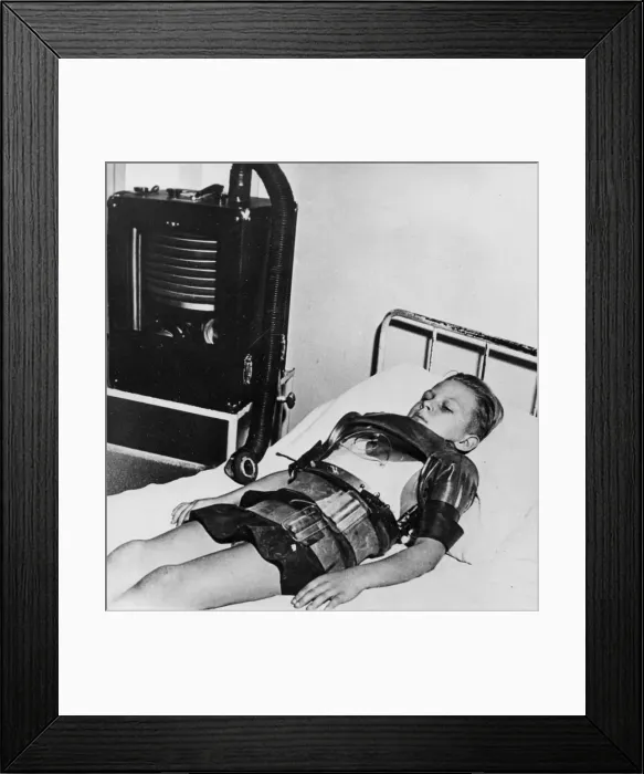 Framed Print : Eleven yeat old boy in an iron lung, Beaujon Hospital, Paris, c1947-1951 Framed Print : Eleven yeat old boy in an iron lung, Beaujon Hospital, Paris, c1947-1951