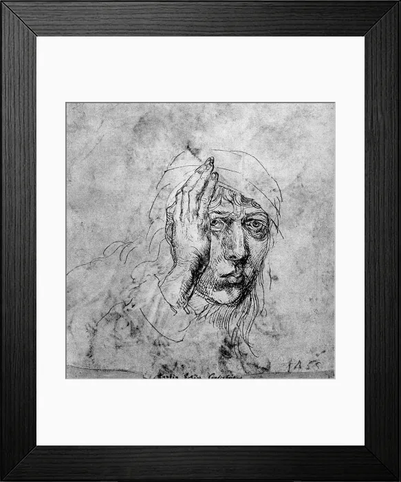 Framed Print : Self Portrait with a Bandage, 1492, (1936). Artist: Albrecht Durer Framed Print : Self Portrait with a Bandage, 1492, (1936). Artist: Albrecht Durer
