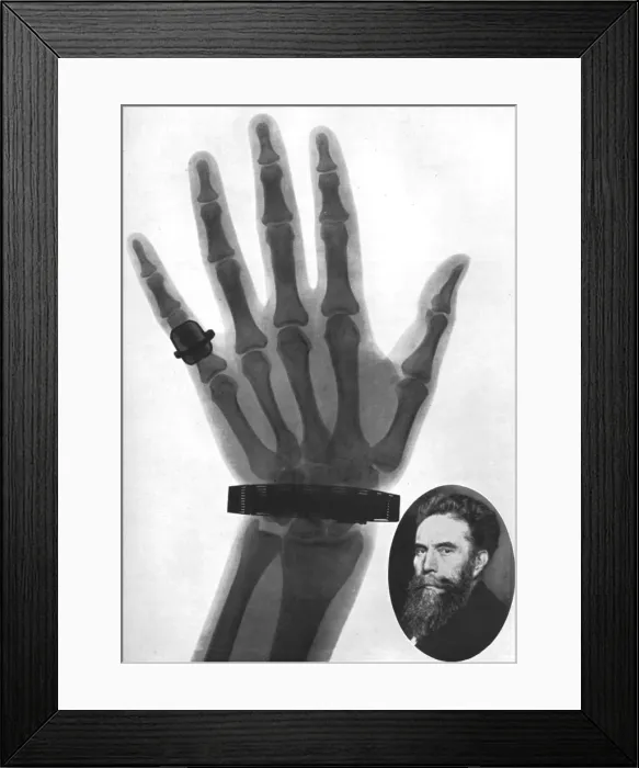 Framed Print : X-ray photograph of a hand, 1926 Framed Print : X-ray photograph of a hand, 1926