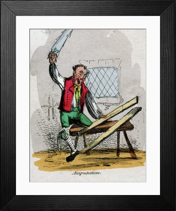 Framed Print : Amputation Framed Print : Amputation