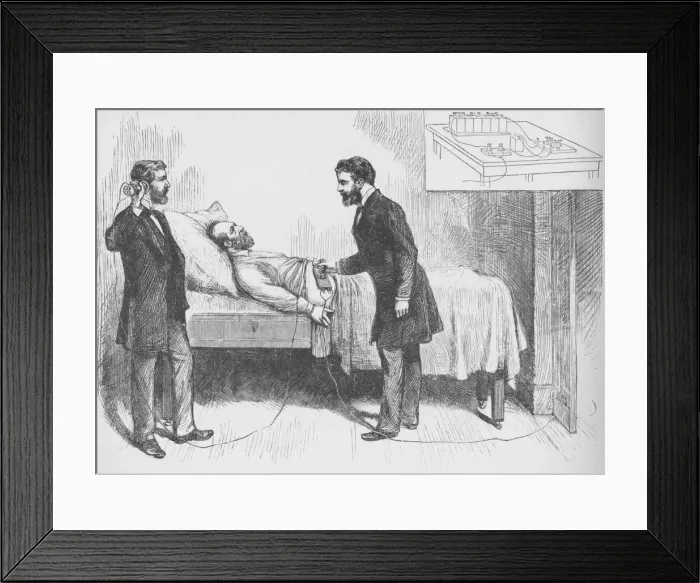 Framed Print : Alexander Graham Bell and assistant use an electrical detector to find a bullet in the torso of ail Artist: W Shinkle Framed Print : Alexander Graham Bell and assistant use an electrical detector to find a bullet in the torso of ail Artist: W Shinkle