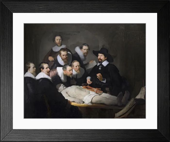 Framed Print : The Anatomy Lesson of Dr. Nicolaes Tulp, 1632. Artist: Rembrandt van Rhijn (1606-1669) Framed Print : The Anatomy Lesson of Dr. Nicolaes Tulp, 1632. Artist: Rembrandt van Rhijn (1606-1669)