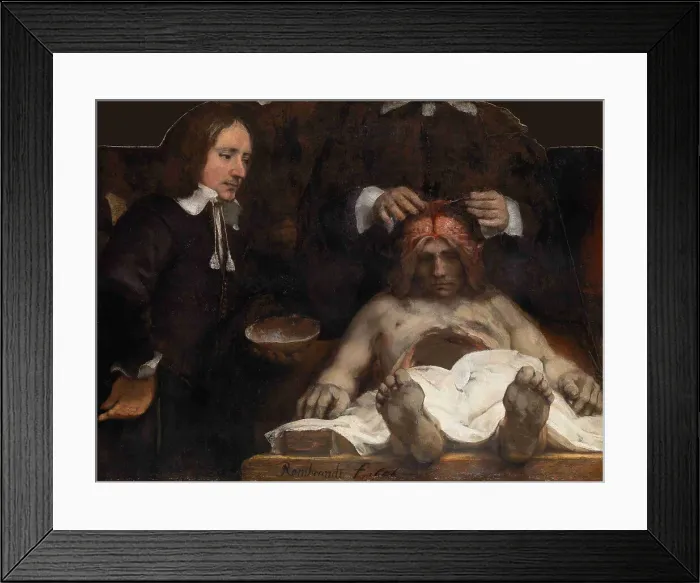 Framed Print : The Anatomy Lesson of Dr. Jan Deijman, 1656. Artist: Rembrandt van Rhijn (1606-1669) Framed Print : The Anatomy Lesson of Dr. Jan Deijman, 1656. Artist: Rembrandt van Rhijn (1606-1669)