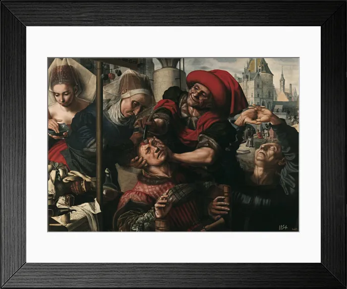 Framed Print : Surgery, 1550-1555. Artist: Hemessen, Jan Sanders, van (c. 1500-c. 1566) Framed Print : Surgery, 1550-1555. Artist: Hemessen, Jan Sanders, van (c. 1500-c. 1566)