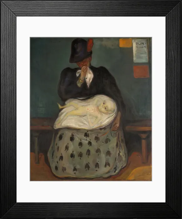 Framed Print : Inheritance (Child born with syphilis) Framed Print : Inheritance (Child born with syphilis)