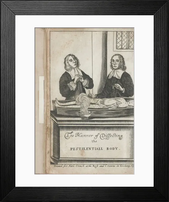 Framed Print : Two men dissecting a body with plague marks, 1666 Framed Print : Two men dissecting a body with plague marks, 1666