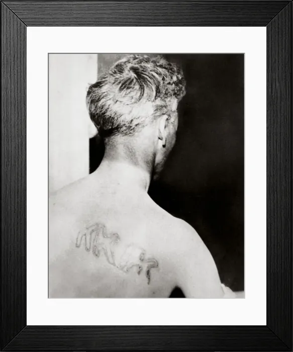 Framed Print : The branded back of Reverend Orrin Van Loon, Detroit, Michigan, USA, July 1924. Artist Framed Print : The branded back of Reverend Orrin Van Loon, Detroit, Michigan, USA, July 1924. Artist