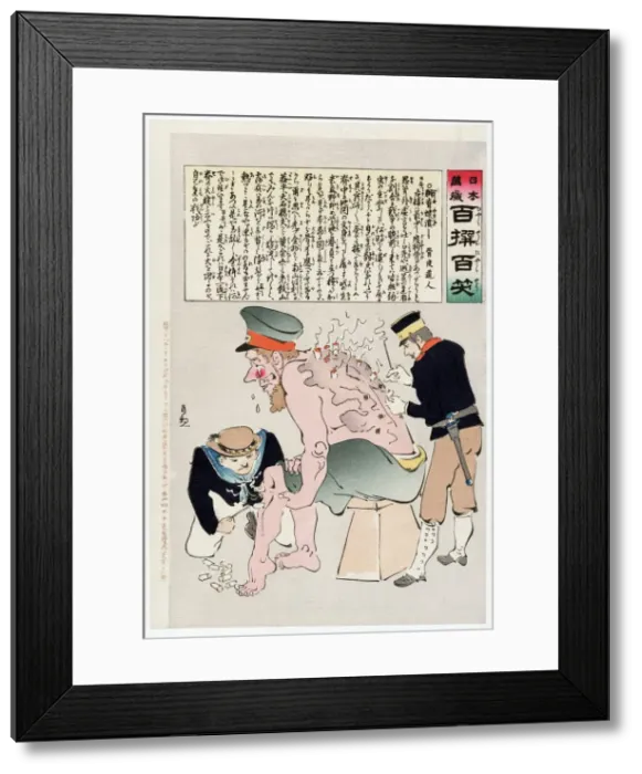Framed Print : Russian Soldier Has His Wounds Attended to by Japenese Military Personnel, 1905 Framed Print : Russian Soldier Has His Wounds Attended to by Japenese Military Personnel, 1905