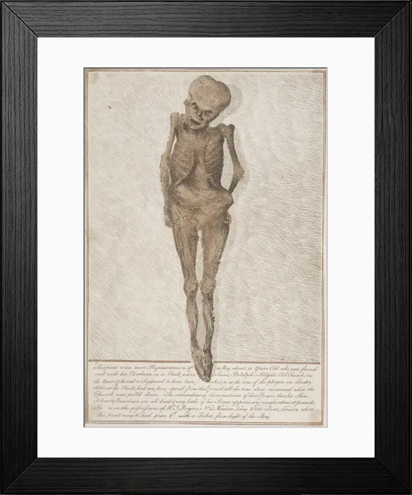 Framed Print : Skeleton of boy found in the vault at St Botolph, Aldgate, London, 1742 Framed Print : Skeleton of boy found in the vault at St Botolph, Aldgate, London, 1742
