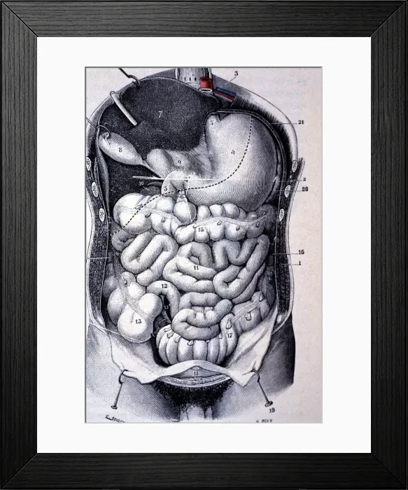 Framed Print : Segments of the colon seen together after resection of the anterior wall of the abdomen and thorax