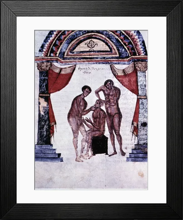Framed Print : Mandibular reduction, miniature in the Surgery Codex in Comments of Apollonius, by