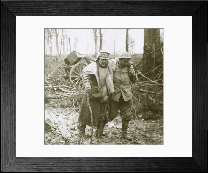 Framed Print : Wounded soldier, Verdun, northern France, 1916 Framed Print : Wounded soldier, Verdun, northern France, 1916