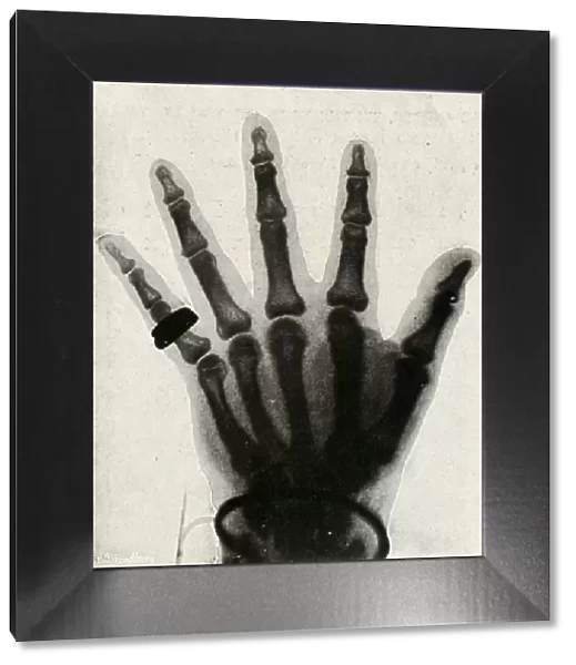Radiograph of the Hand of H. R. H. The Prince of Wales, (c1897)