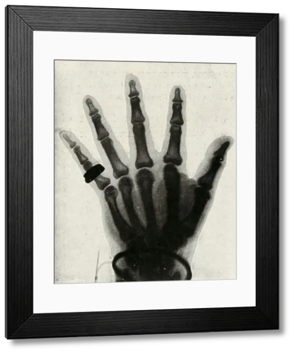 Framed Print : Radiograph of the Hand of H. R. H. The Prince of Wales, (c1897) Framed Print : Radiograph of the Hand of H. R. H. The Prince of Wales, (c1897)