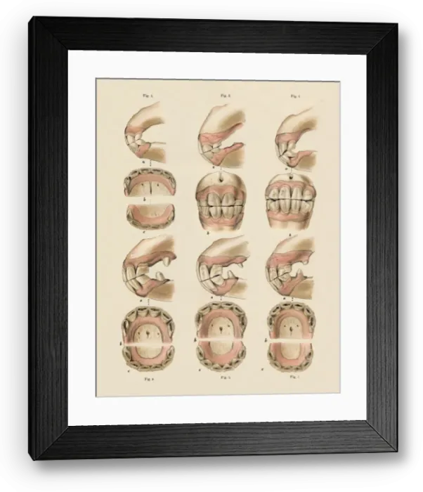 Framed Print : Description of Plate Showing the Age, As Indicated By The Teeth, c1879. Creator: Unknown Framed Print : Description of Plate Showing the Age, As Indicated By The Teeth, c1879. Creator: Unknown