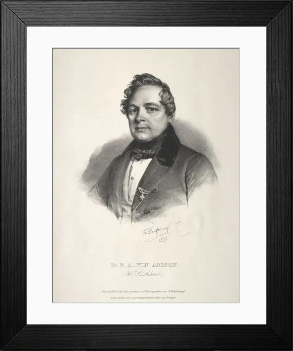 Framed Print : Dr. Friedrich August von Ammon, 1838. Creator: Franz Seraph Hanfstaengl (German, 1804-1877) Framed Print : Dr. Friedrich August von Ammon, 1838. Creator: Franz Seraph Hanfstaengl (German, 1804-1877)