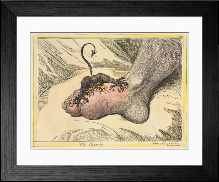 Framed Print : The Gout, 1799. Creator: James Gillray (British, 1757-1815); Hannah Humphrey Framed Print : The Gout, 1799. Creator: James Gillray (British, 1757-1815); Hannah Humphrey