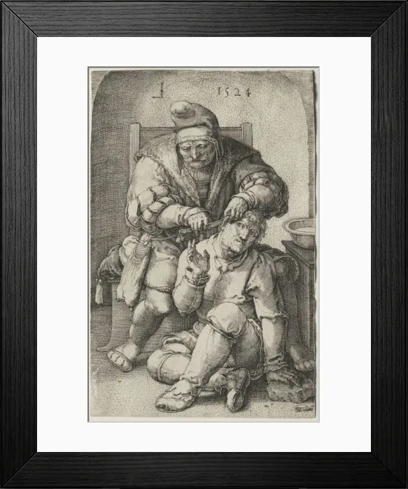 Framed Print : The Surgeon, 1524. Creator: Lucas van Leyden (Dutch, 1494-1533) Framed Print : The Surgeon, 1524. Creator: Lucas van Leyden (Dutch, 1494-1533)