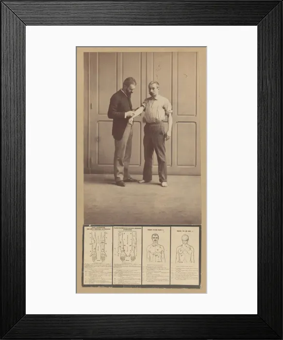 Framed Print : Notation of Scars, Schematic Drawings, ca. 1893. Creator: Alphonse Bertillon Framed Print : Notation of Scars, Schematic Drawings, ca. 1893. Creator: Alphonse Bertillon