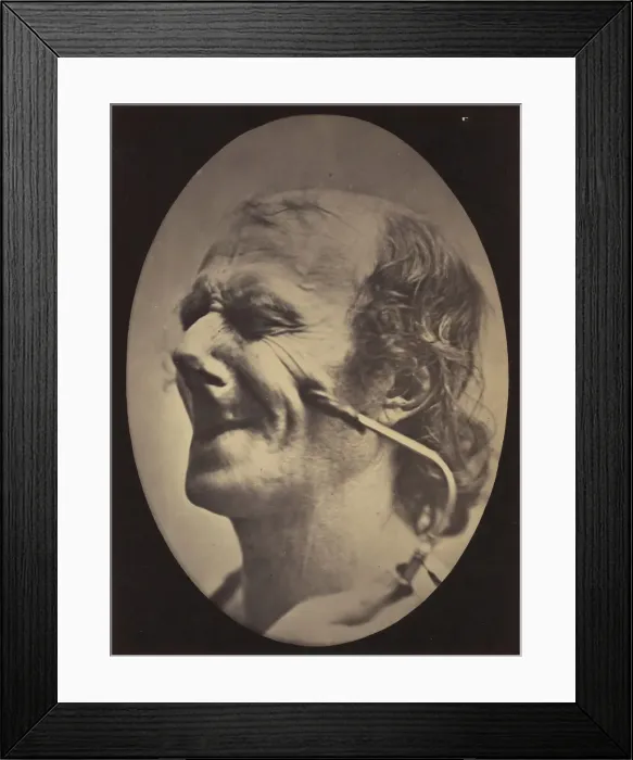 Framed Print : Figure 6: The grimace produced is similar to a tic of the face, 1854-56, printed 1862 Framed Print : Figure 6: The grimace produced is similar to a tic of the face, 1854-56, printed 1862