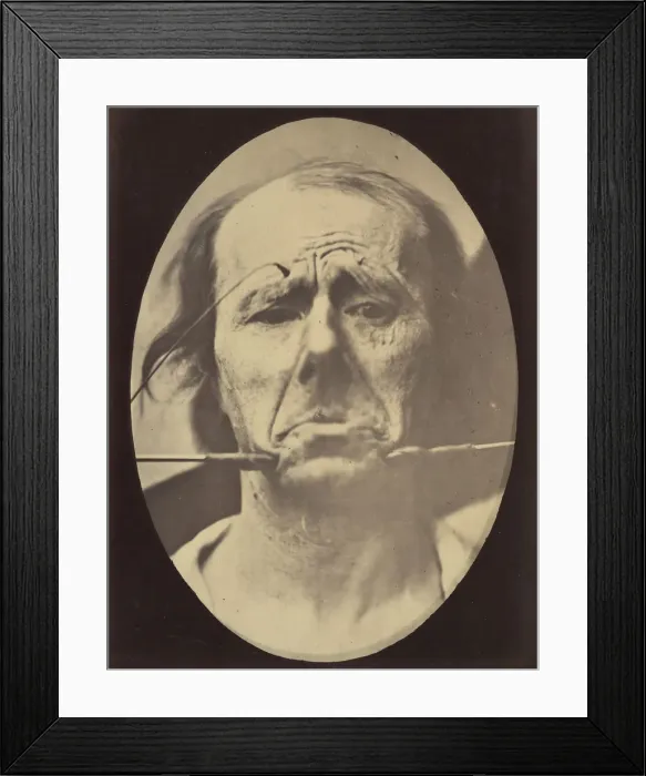 Framed Print : Figure 45: Pain and despair. 1854-56, printed 1862. Creators: Duchenne de Boulogne Framed Print : Figure 45: Pain and despair. 1854-56, printed 1862. Creators: Duchenne de Boulogne