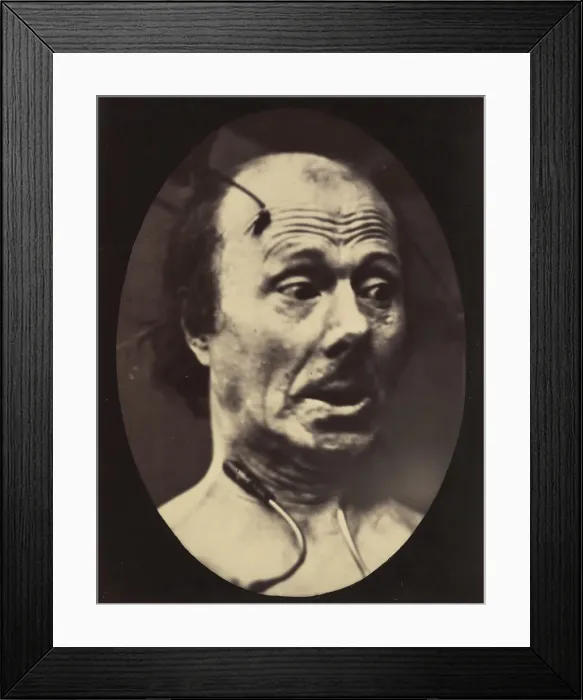 Framed Print : Figure 60: Fright, 1854-56, printed 1862. Creators: Duchenne de Boulogne Framed Print : Figure 60: Fright, 1854-56, printed 1862. Creators: Duchenne de Boulogne